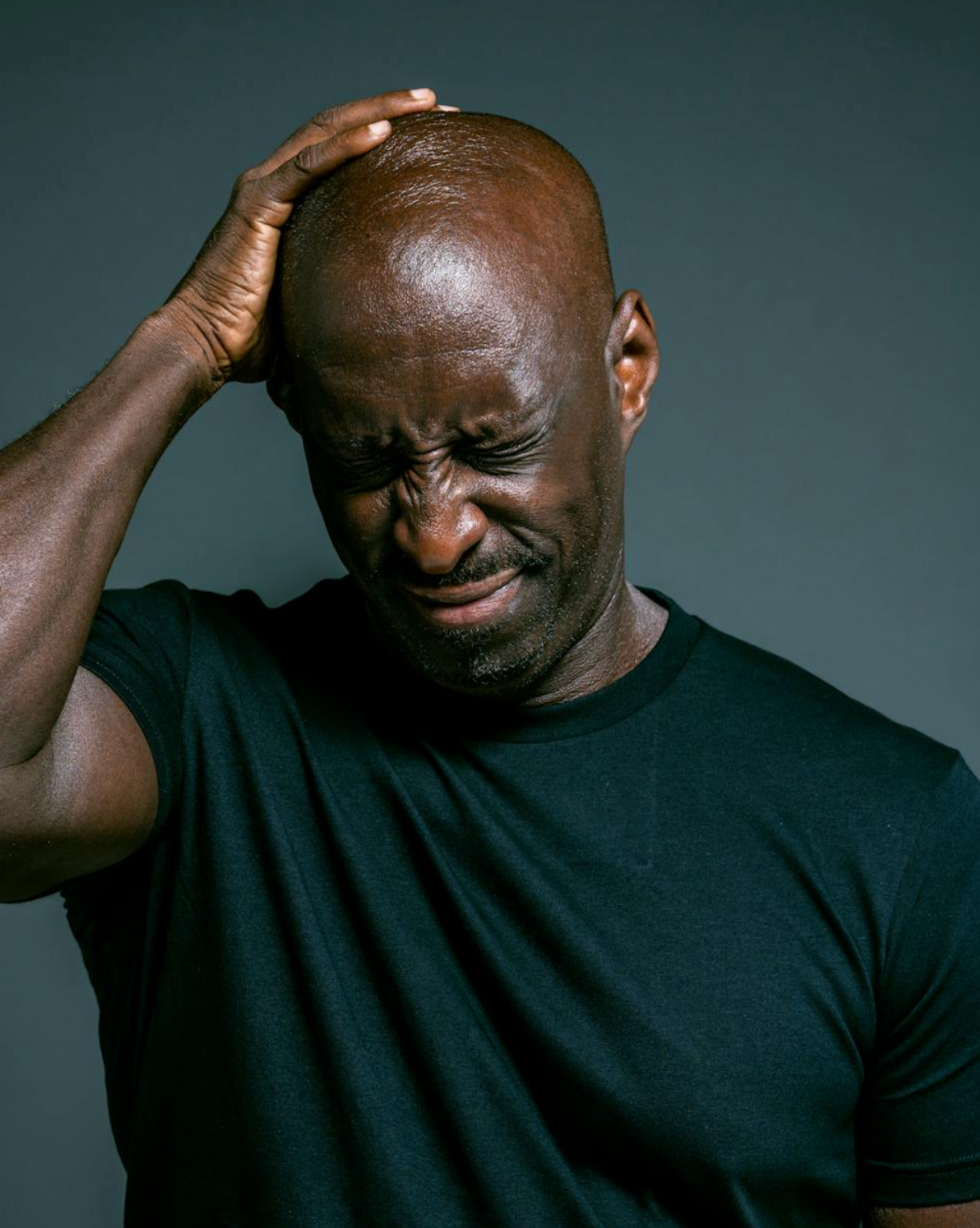 Les hormones responsables de la calvitie