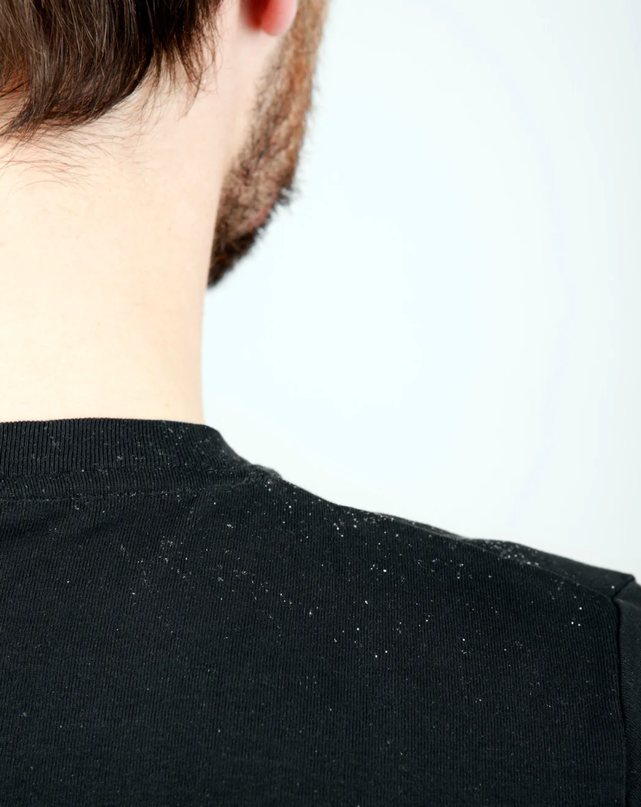 Différence entre pellicules sèches et pellicules grasses